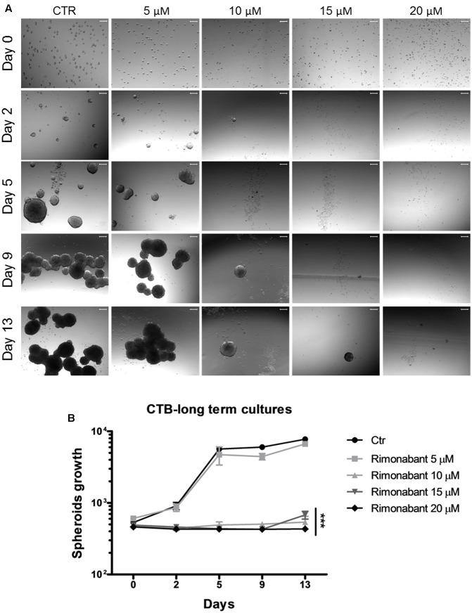 (A) Representative images of GTG7 clones after 24 h of treatment with Rimonabant (or vehicle control) starting from day 0 (corresponding to the end of treatments) and until day 13. Growth of spheroidal clones was monitored in three independent experiments in triplicate. Scale bar = 100 μm. (B) Cell Titer Blue (CTB) colorimetric assay in GTG7 treated for 24 h, as described. Data are expressed as mean ± SD of at least three independent experiments in triplicate (∗∗∗p < 0.005 vs. control).