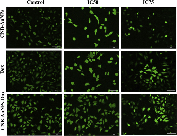Qualitative evaluation of ROS in H2DCFDA stained A549 cells treated with IC50 and IC75 of CNB-AuNPs-Dox, Dox, and CNB-AuNPs for 24 h analyzed by fluorescence microscopy. The images shown are representative of three independent experiments (Scale bar: 100μm; Magnification: ×20).