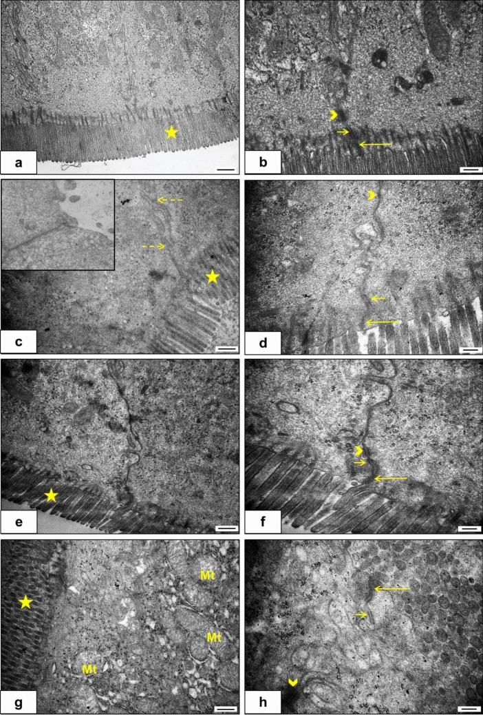 The ultrastructural findings of the groups. a–b: C group (n = 4), c–d: HFD group (n = 3), the small square in c: Showing one case which has loss of microvilli on a large number of enterocytes, e–f: THC group (n = 3), g–h: HFD + THC group (n = 3). Star: microvilli, Mt: mitochondria, long arrow: zonula occludens, short arrow: zonula adherens, arrowhead: desmosome, dashed arrow: basolateral folds. The bar scale size (a, c, e, g) = 500 nm. The bar scale size (b, d, f, h) = 200 nm