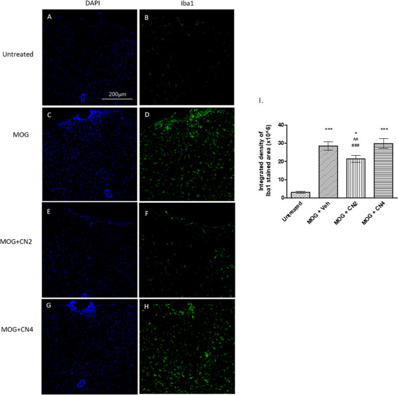 Microglial activation in the spinal cord of cannabis-treated mice. Female C57BL / 6 mice treated with MOG35-55 were treated with vehicle, CN2, or CN4. Spinal cords were removed and cut horizontally. The sections were stained by immunohistochemistry using antibodies against activated microglia (green), and the cell nuclei were stained by DAPI (blue) and examined using a confocal microscope (X20 magnification). The images (A-H) are representative images of 2 independent experiments, with 5 mice in each treatment group. In I, the presented results are mean ±SEM of the color intensity to the area of the Iba1 results (B,D,F,H), n ≥ 20 *** - p <0.001 vs. control, * p <0.05 vs. control , ^^ p <0.01 vs. MOG, ### p <0.001 vs. CN4