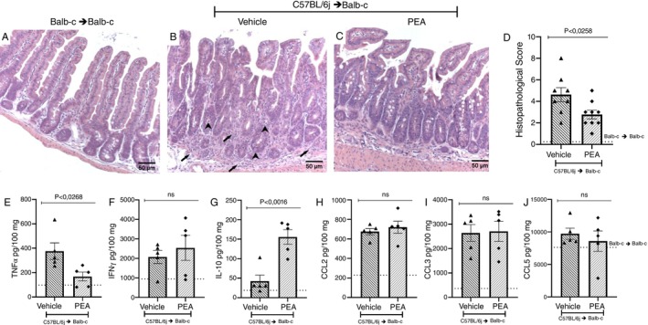 PEA protects the intestine by reducing damage and increasing IL‐10. Slices of intestine of the syngeneic group and allogeneic recipient mice treated with vehicle or PEA (A–C) on the 7th day after disease induction, were fixated and stained with H&E for analysis of their (D) histopathological score. Samples of the intestines were collected, processed and the ELISA assay was performed, and the concentration of the chemokines (E) TNF‐α, (F) IFN‐γ, and (G) IL‐10 and the cytokines (H) CCL2, (I) CCL3 and (J) CCL5 were verified. Treatment was performed from Day 0 until the end of the experiment. Groups were considered significantly different when p < 0.05, compared to the allogeneic group. Assessed by unpaired parametric two‐tailed Student's t test (n = 8–9 for the histopathological score n = 5 for the quantification of Inflammatory mediators). The N for the histopathological score was result of two experiments.