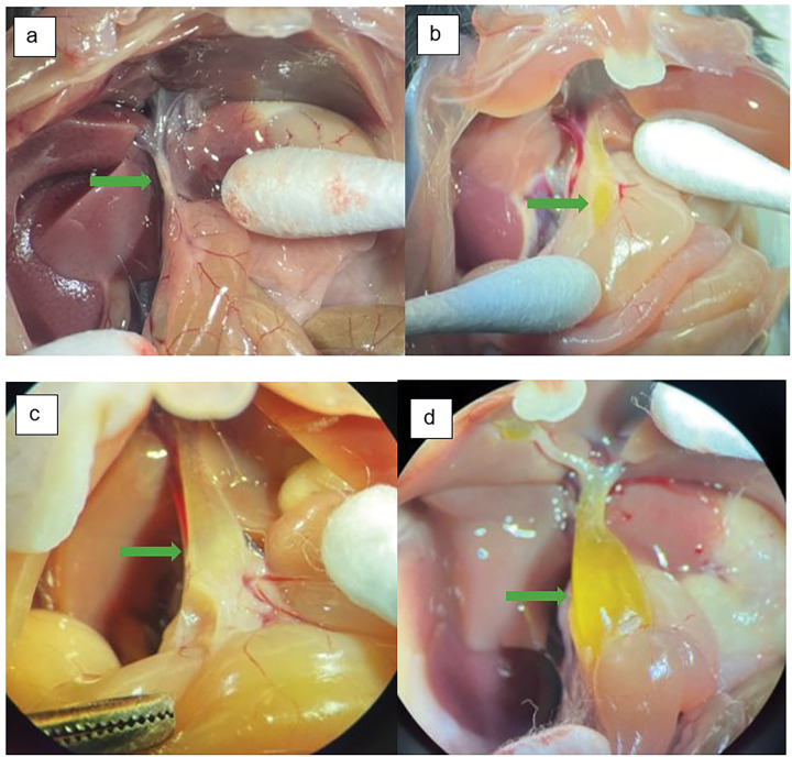 Mouse bile ducts were photographed upon necropsy at 12-weeks of age; The green arrow in each image denotes the point of approximate maximum extrahepatic bile duct diameter a control mouse bexperimental mouse with mild choledochal cyst c experimental mouse with moderate choledochal cyst d experimental mouse with severe choledochal cyst