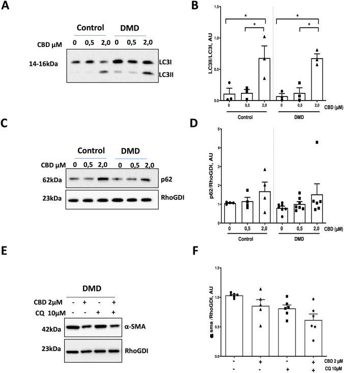 CBD reverses the myofibroblast phenotype in hiPSC-cFib from DMD patients independently of metabolic and autophagy regulation.(A–B) Representative western blots and quantification of the LC3B-II/LC3B-I ratio and p62 (C–D) in hiPSC-cFib derived from healthy controls and DMD patients treated with CBD (0.5–2 μM, 24 h). Data are presented as mean ± SEM from n = 3 healthy donors and n = 3 DMD patients, with technical replicates of biological samples obtained from independent hiPSC-cFib differentiation batches. Statistical differences between treatments in control and DMD groups were determined using a non-parametric one-way ANOVA. *P < 0.05.(E–F) Representative western blots and quantification of α-SMA protein expression in hiPSC-cFib from DMD patients treated with CBD (2 μM), chloroquine (CQ, 10 μM). Data are presented as mean ± SEM from three healthy donors and three DMD patients, with technical replicates derived from independent hiPSC-cFib differentiation batches of biological samples. Statistical differences between conditions in DMD group were determined using a non-parametric one-way ANOVA.