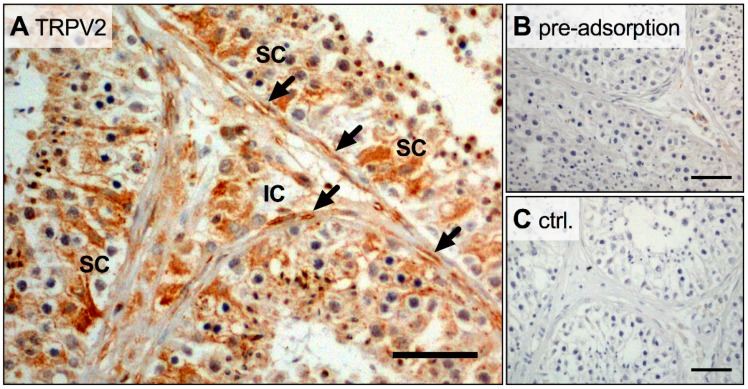 Broad expression of TRPV2 in human testis. (A–C) In human testicular slices, immunohistochemistry showed TRPV2 signals in Sertoli (SC), interstitial (IC) and in peritubular cells (arrows). In both controls, pre-adsorption with TRPV2 peptide (B) and omission of the primary antibody (C), no TRPV2 signal could be detected. Scale bar 100 µm.
