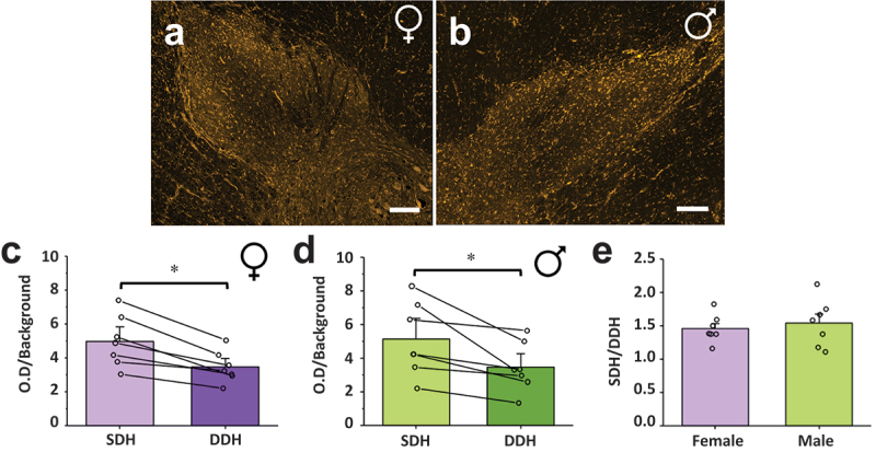 CB1 receptor immunoreactivity is increased in the SDH compared to the DDH in female and male humans. Representative confocal images of CB1 immunoreactivity in the dorsal horn of (A) female and (B) male human organ donors, side by side for direct comparison. The normalized CB1 optical density in the SDH of rats is statistically higher than the normalized optical density in the DDH for (C) female and (D) male humans. *P < .05. (E) A ratio comparing the normalized CB1 optical density of the SDH versus the DDH reveals that the increased optical density of CB1 receptors in the SDH of humans is conserved across sex. n = 6. Scale bar = 200 µm.