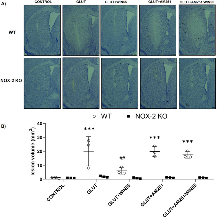 Lesion volume in WT and NOX‐2 KO mice after glutamate intracerebral administration and treated with or without WIN55, AM251, and AM251/WIN55. The lesion was evaluated after 24 h of the intracerebral glutamate (GLUT) injection (n = 3). (A) Representative micrographs of coronal striatal sections stained with cresyl violet. The scale bars represent 200 μm. (B) Quantification of the lesion volume is expressed in cubic millimeters. Results were expressed as means ± standard deviation ***p < 0.001 versus the corresponding control; ##p < 0.01 versus the corresponding mice treated with glutamate (GLUT).