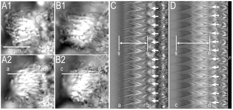 Video images of ciliated human nasal epithelial cells (cHNECs) in primary culture (apical view). The cHNECs were perfused with the CO2/HCO3−-free control solution. (A) Just before daidzein stimulation. (B) 15 min after daidzein stimulation (100 μM). Panels A1 and A2, and panels B1 and B2, show the start and the end of an effective stroke in a ciliary beating cycle, respectively. We set the lines “a–b’’ (A2) and “c–d’’ (B2) on the same beating cilia of a cHNEC in the video image to calculate the light intensity changes using the analysis program. (C) Changes in the light intensity of the line a–b (A2) in an unstimulated cHNEC. The image of light intensity changes enabled us to measure ciliary beat frequency (CBF) and ciliary beat distance (CBD). The two white lines in panel C show both the start (“s’’) and the end (“e’’) of an effective stroke. We measured the distance (pixels) from the line “s” to the line “e” as CBD. The number of arrows (right side) shows CBF. (D) Changes in the light intensity of the line “c–d’’ in the cHNEC 15 min after daidzein stimulation (100 μM). Daidzein stimulation enhanced CBD, but not CBF. Experiments were carried out at 37 °C.
