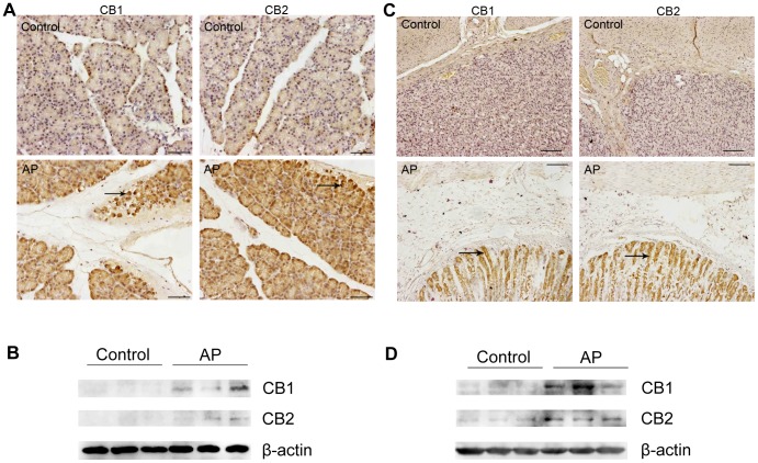 Expression of CB1 and CB2 receptors in rat pancreas and stomach by immunohistochemistry and western blot analyses.(A) Immunohistochemical detection of CB1 and CB2 receptors in rat pancreatic tissue sections, with the arrowheads showing the specific CB1/CB2 staining. (B) Western blot staining of CB1 and CB2 receptors in rat pancreatic tissue lysates. (C) Immunohistochemical detection of CB1 and CB2 receptors in rat stomach tissue sections, with the arrowheads showing the specific CB1/CB2 staining. (D) Western blot staining of CB1 and CB2 receptors in rat stomach tissue lysates. Note that the pancreatic acini and gastric mucosa exhibit increased immunological activity for CB1 and CB2 receptors after the induction of acute pancreatitis. (Original magnification: ×200, and scale bar = 50 µm).