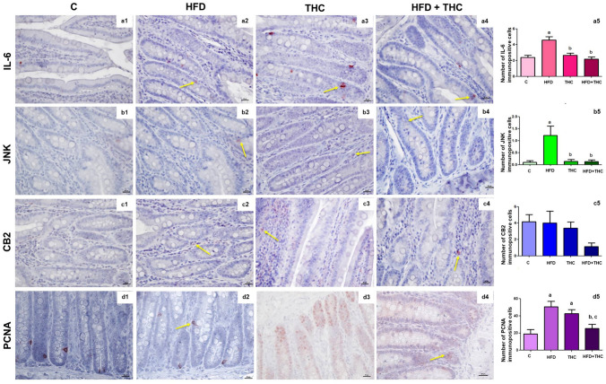 a1–a4: Representative micrographs for IL-6 immunostaining. a5: Numbers of the IL-6 immunopositive cells, ap < 0.001 vs. C group; bp < 0.001 vs. HFD group. b1–b4: Representative micrographs for JNK immunostaining. b5: Numbers of the JNK immunopositive cells, ap < 0.01 vs. C group, bp < 0.01 vs. HFD group. c1–c4: Representative micrographs for CB2 immunostaining. c5: Numbers of the CB2 immunopositive cells, a,b,cp > 0.05. d1–d4: Representative micrographs for PCNA immunostaining. d5: Numbers of the PCNA immunopositive cells, ap < 0.001 vs. C group, bp < 0.001 vs. HFD group, cp < 0.01 vs. THC group. The bar scale size = 20 µm