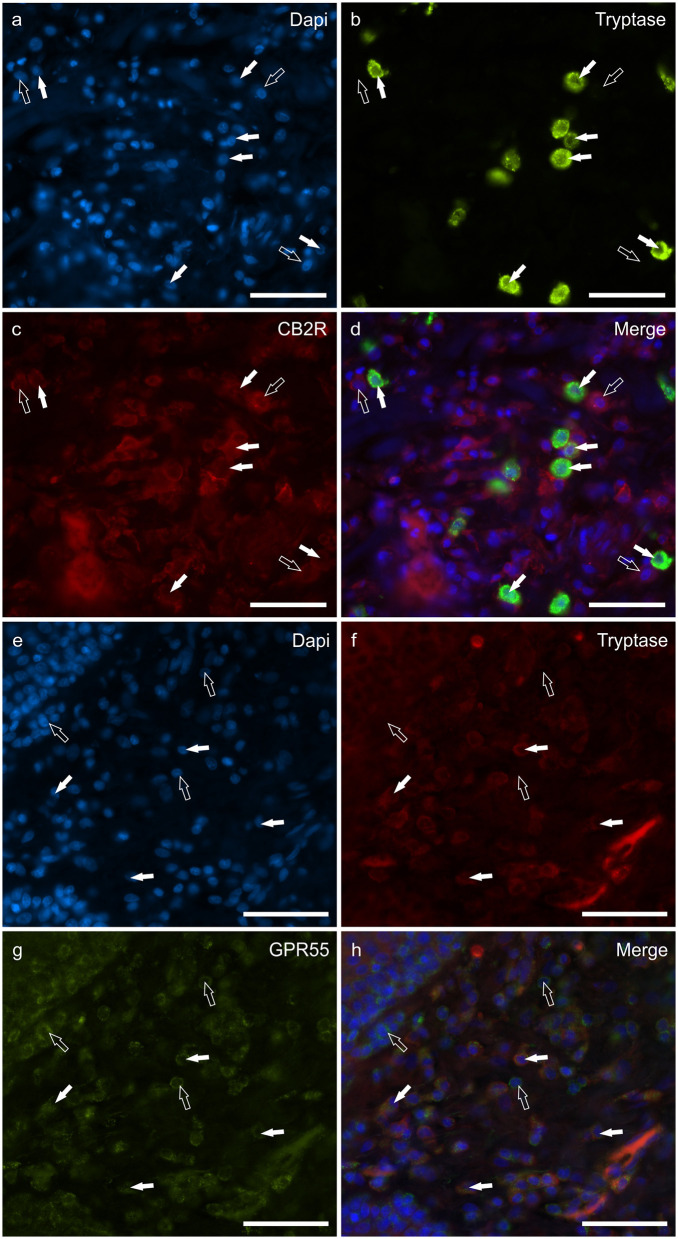 Photomicrographs of the cryosections of the skin of dogs with atopic dermatitis (AD) showing tryptase immunoreactive mast cells (MCs) expressing cannabinoid receptor 2 (CB2R) (a–d) and G-protein coupled receptor 55 (GPR55) (e–h) immunoreactivity (IR). The white arrows indicate the Dapi-labeled nuclei of tryptase positive MCs co-expressing CB2R- (c) and GPR55-IR (g). The open arrows indicate some tryptase negative cells of the dermis which expressed CB2R- (c) and GPR55-IR (g). Bar: 50 μm.