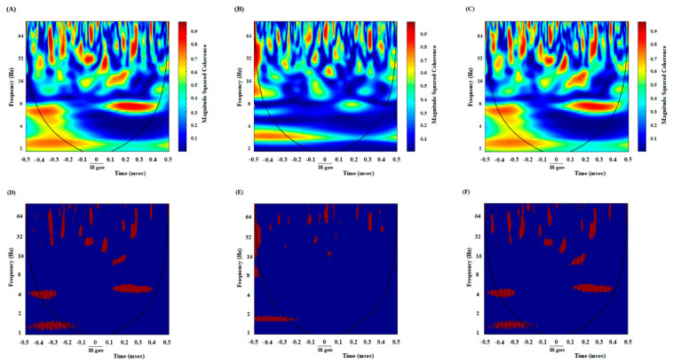 Comparison of coherence of group averages between high remuneration/high endeavor trials in the control group (A), low remuneration/low endeavor trials in the agonist-treated group (B), and high remuneration/high endeavor trials in the antagonist-treated group (C) during reaching remuneration. Time-frequency representation of group averages coherence between the ACC and NAc for n = 53 trials. The cone of influence (COI) where edge effects should be considered is blurred. It should be noted that the wavelet scales are converted to approximate frequencies on the graphs. Comparison of areas in which the coherence is significantly different compared to a large number of surrogate data between high remuneration/high endeavor trials in the control group (D), low remuneration/low endeavor trials in the agonist-received-group (E), and high remuneration/high endeavor trials in the antagonist-received group (F) while reaching a remuneration. The red regions in the figures show the areas with a significant difference (p < 0.05). Surrogate data were simulated using bootstrapping (n = 1000).