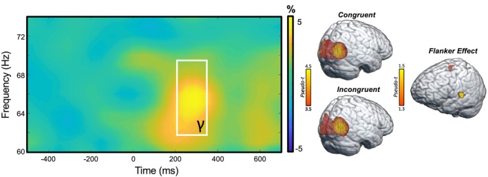 Grand‐averaged spectrogram and whole‐brain maps. (Left): Grand‐averaged time‐frequency spectrogram of an MEG sensor exhibiting a significant gamma response (62–70 Hz, 200–350 ms). The spectrogram displays frequency (Hz) on the y‐axis and time (ms) on the x‐axis. Signal power is expressed as a percent difference from the baseline period, with the color legend shown to the right of the spectrogram. (Right): Grand‐averaged beamformer images (pseudo‐t) across all participants for the gamma oscillatory response shown in the spectrogram for the congruent condition (Right, top), incongruent condition (Right, bottom), and flanker interference effect (i.e., incongruent—congruent; right, middle).