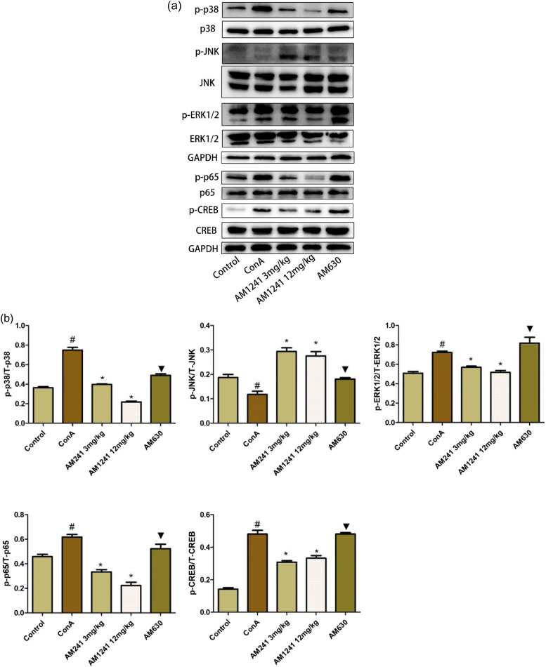The effects of AM1241 on the mitogen-activated protein kinase pathway in the ConA-induced hepatitis mouse model. (a) The expression of p38, p-p38, JNK, P-JNK, ERK1/2, p-ERK1/2, p65, p-p65, cAMP response element-binding protein and p-cAMP response element-binding protein levels were detected using Western blot. (b) The results of the Western blots were analysed with ImageJ. Data are expressed as the mean ± SEM (n = 6; #p < 0.05 for ConA versus control; *p < 0.05 for AM1241 groups versus ConA; ▼p < 0.05 for AM630 versus AM1241 groups).