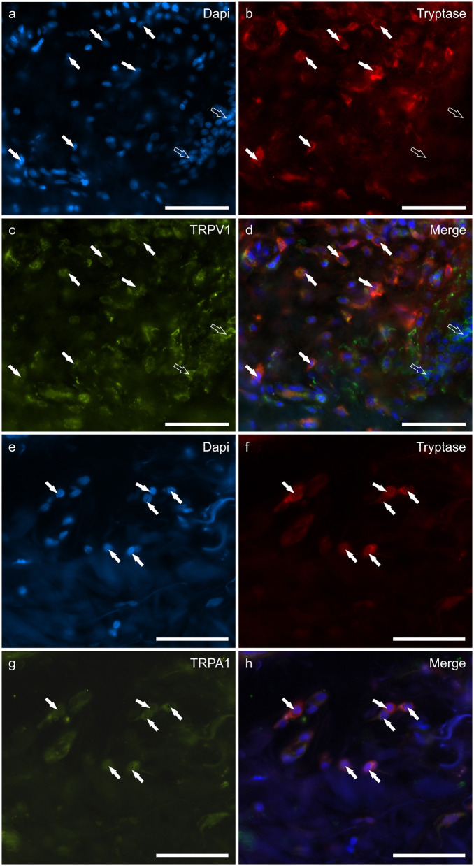 Photomicrographs of the cryosections of the skin of dogs with atopic dermatitis (AD) showing tryptase immunoreactive mast cells (MCs) expressing transient receptor potential vanilloid 1 (TRPV1) (a–d) and transient receptor potential ankyrin 1 (TRPA1) (e–h) immunoreactivity (IR). The white arrows indicate the Dapi-labeled nuclei of tryptase positive MCs co-expressing TRPV1- (c) and TRPA1-IR (g). The open arrows indicate some tryptase negative cells of the dermis which expressed TRPV1-IR (c). Bar: 50 μm.