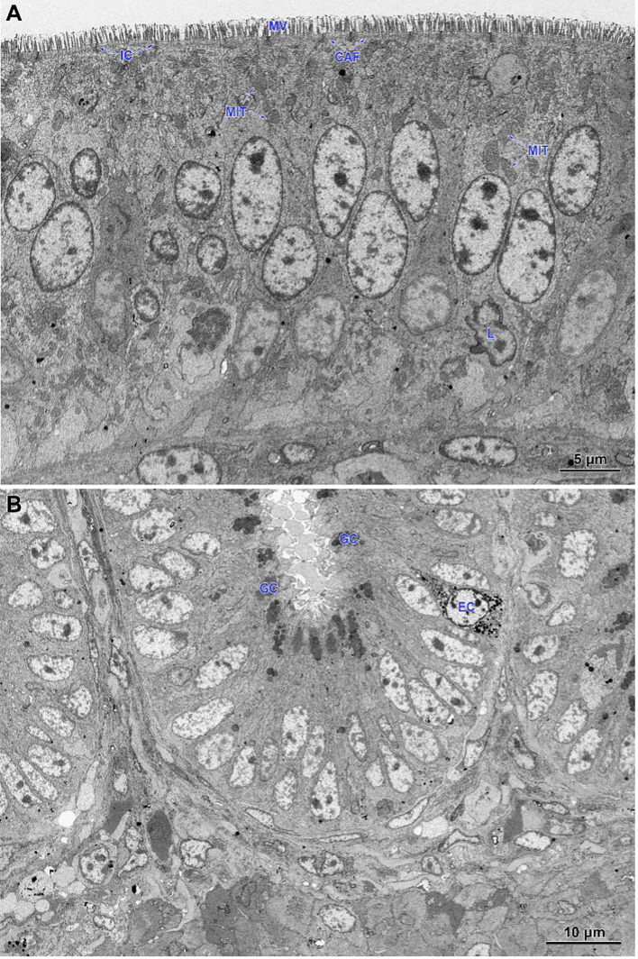 Ultrastructure of the jejunum of non-infected chicken receiving CBD + nano-Se. (A) Epithelium covering the villus. Note the regular shape and arrangement of cells. (B) The lower part of the intestinal gland is composed of immature cells. MIT, mitochondria; MV, microvilli; CAF, cortical actin filaments; IC, intercellular junctions; L, lymphocytes; GC, goblet cells; EC, enteroendocrine cells.