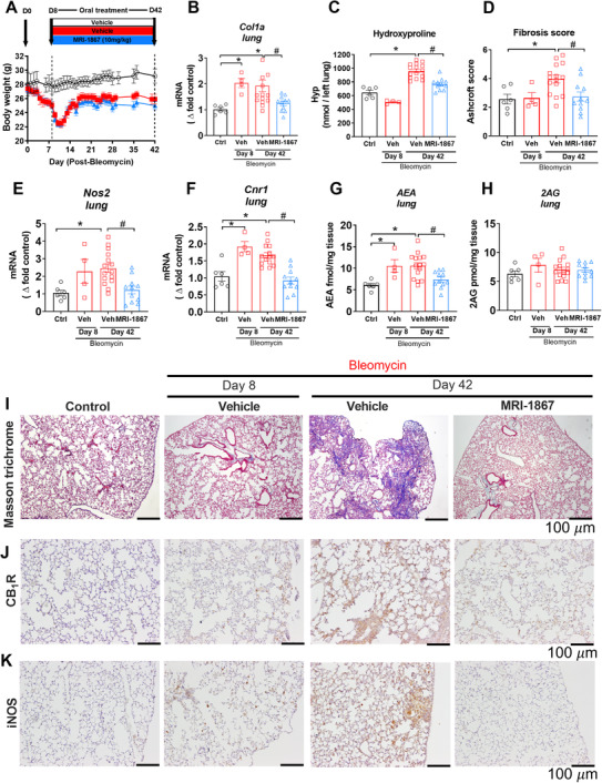 Target engagement and efficacy of MRI‐1867 in experimental model of HpsPF in pale ear mice. (A) Body weight change in Sc‐Bleo (60 U/kg)‐induced PF. (B) Gene expression of fibrosis marker collagen 1a (Col1a). (C) Hydroxyproline content of the left lung. (D) Ashcroft scoring from the Masson trichrome staining. Lung tissue gene expression of Nos2 (E) and Cnr1 (F). Levels of endocannabinoid AEA (G) and 2AG (H) in lung tissue. Masson trichrome staining (I). CB1R (J) and iNOS (K) immunostainings from lung tissue sections from control and bleomycin (60 U/kg) challenged pale ear mice. Data represent mean ± SEM from 6 control (Ctrl, pale ear mice infused with saline instead of bleomycin), 4 HpsPF with bleomycin+vehicle at day 8 (Veh), 15 HpsPF with bleomycin+ vehicle at day 42 (Veh), and 11 HpsPF with bleomycin+MRI‐1867 (MRI‐1867) at day 42. Data were analyzed by one‐way ANOVA followed by Dunnett's multiple comparisons test. * (p < 0.05) indicates significant difference from the control group. # (p < 0.05) indicates significant difference from the HpsPF mice treated with vehicle (Veh) at 42 day