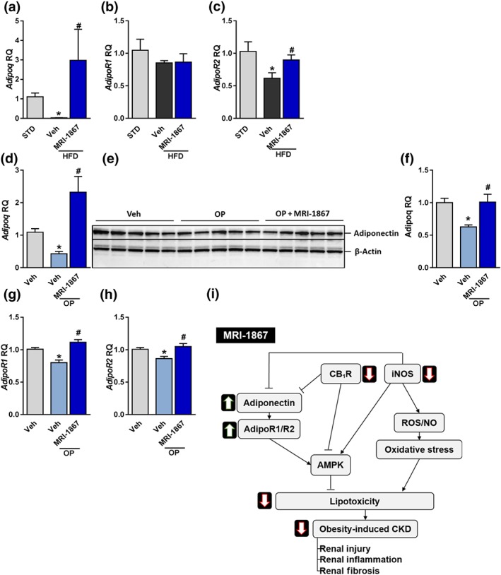 MRI‐1867 reverses the fatty acid‐induced reduction in adiponectin signalling. Mice on standard diet (STD) or high‐fat diet (HFD) for 18 weeks were treated with vehicle (Veh) or MRI‐1867 (3 mg·kg−1) orally for 28 days. (a–c) MRI‐1867 restored the HFD‐induced reduction in the mRNA renal expression of adiponectin, and Adipo2 but not Adipo1 receptors. Similarly, exposing HK‐2 cells to O:P (0.5 mM, 2:1, respectively) resulted in reduced (d–f) mRNA and protein expression of adiponectin as well as reduced mRNA levels of (g) Adipo1 and (h) Adipo2 receptors. Pretreatment of the cells with MRI‐1867 (100 ng·ml−1) completely normalized these changes. (i) A proposed mechanism for the dual blockade of CB1 receptors and inducible NOS by MRI‐1867 in reversing obesity‐induced chronic kidney disease (CKD) is shown. RQ, relative quantitation. In vivo data represent the mean ± SEM from 8 to 14 mice per group. * P < .05, significantly different from animals on STD; # P < .05, significantly different from animals on the same diet. In vitro data represent the mean ± SEM from five independent experiments. * P < .05, significantly different from Veh‐treated cells under normal conditions; # P < .05, significantly different from Veh‐treated cells under O:P conditions. Data were analysed by one‐way ANOVA, followed by a Bonferroni post hoc test