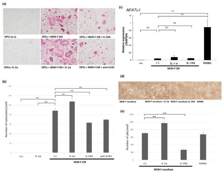 The effects of IL-1 and IL-1RA on osteoclastogenesis induced by the culture supernatant of NEM-F cells and on the expression of NFATc1 in these cultures. (a) Evaluation of the effects of IL-1, IL-1RA, and an antagonistic antibody for IL-1R1 on osteoclastogenesis induced by the culture supernatant of NEM-F cells. Representative views of TRAP staining after 5 days of culture. (b) The number of osteoclasts induced by the culture supernatant of NEM-F cells with or without treatment with IL-1, IL-1RA, or an antagonistic antibody for IL-1R1. ** p < 0.01 (one-way ANOVA with the Dunnett’s method). (c) Quantitative PCR analysis of the expression of NFATc1 in OPCs cultured with culture supernatant of NEM-F cells with or without supplementation of IL-1RA or IL-1α relative to the expression in OPCs cultured with the growth medium with or without supplementation of RANKL. ** p < 0.01, ns: not significant (one-way ANOVA with the Tukey–Kramer method). (d) Evaluation of the effects of IL-1 and IL-1RA on the osteolytic function of induced osteoclasts by the coculture of NEM-F cells and OPCs using a pit formation assay. Representative views of formatted pits after 6 days of culture. (e) The number of pits formed by osteoclasts induced by the coculture of NEM-F cells and OPCs with or without supplementation of IL-1RA or IL-1α. ** p < 0.01 (one-way ANOVA with the Dunnett’s method).