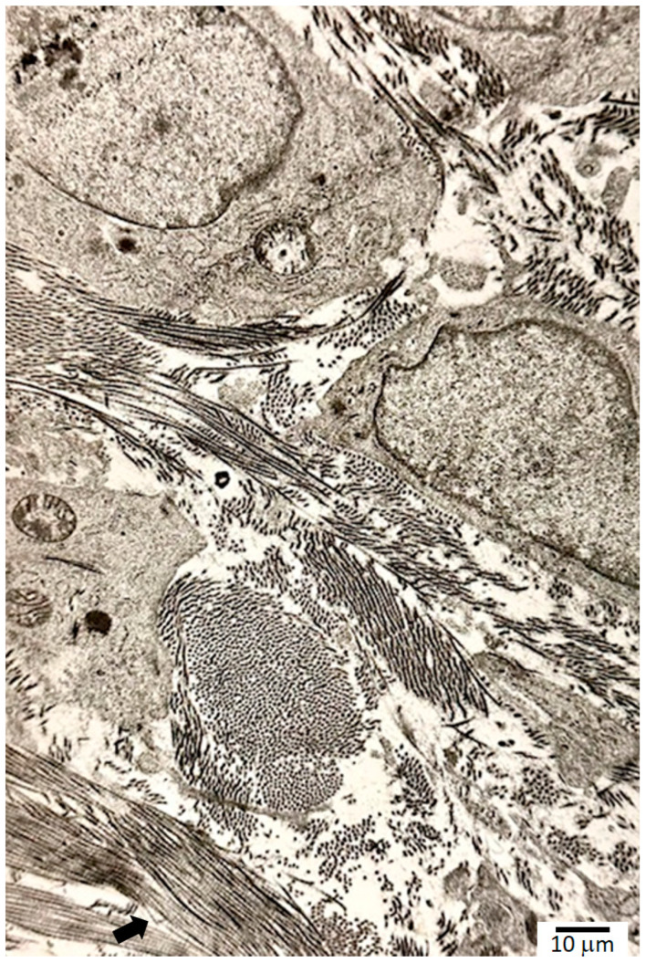Transmission electron microscopy of fibroblasts and collagen, showing near-orthogonal fiber orientations. The 640 nm cross-banding pattern of the triple helix is visible in the lower left corner (arrow).