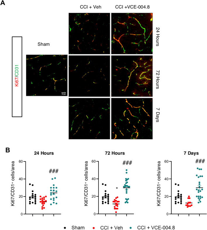 VCE-004.8 upregulates angiogenesis after TBI: endothelial cell proliferation. A Representative immunofluorescence images for CD31 and Ki67 expression in the pericontusional cortex at 24 h, 72 h and 7 days after the brain injury. Scale bar equivalent to 25 µm. B The quantification of Ki67+/CD31+ cells per area is represented as mean ± SEM, and significance was determined by one-way ANOVA followed by the Tukey’s post hoc test. 24 h: p = 0.0002; ###p < 0.001, 72 h and 7 days: p < 0.0001; ###p < 0.001 CCI + VCE-004.8 vs CCI + Vehicle