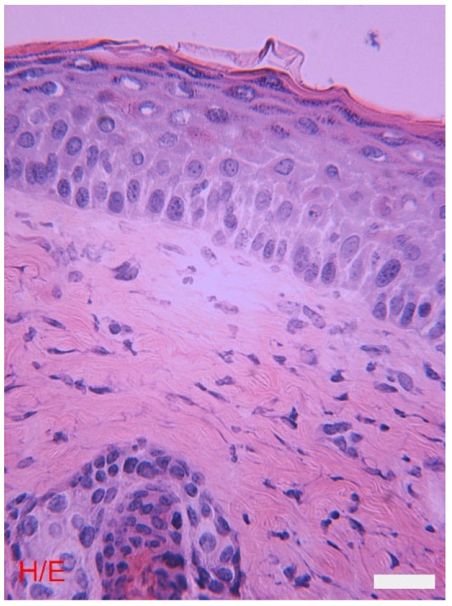The skin: Morphological differences between the epidermis and the dermis. In the epidermis the various layers that compose it. The underlying dermis has various cell types, a sebaceous gland and a hair follicle. Light microscopy, hematoxylin and eosin, scale bar = 10 μm [15].