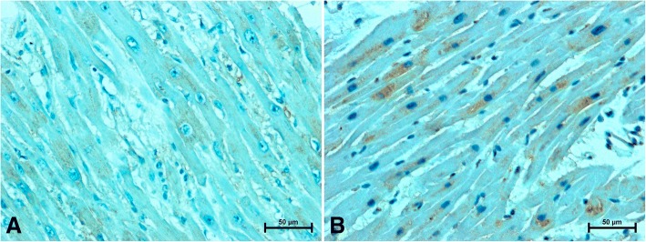 Positive S100A6-immunostaining in heart of women (a) under 50 years old and (b) women over 50