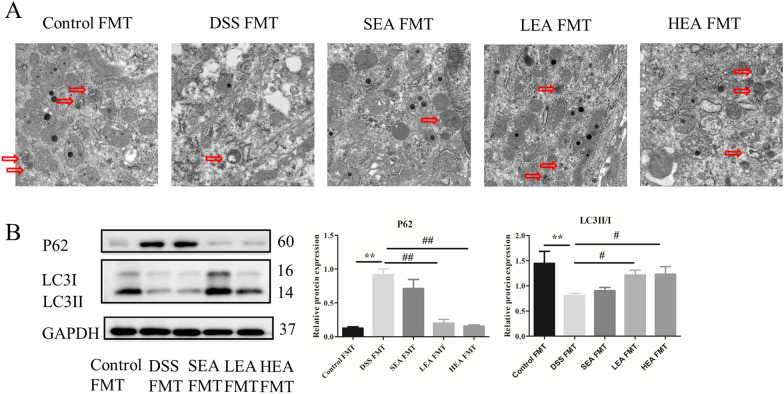 EA FMT strengthened the degree of autophagy. A The autophagosome in the colon. B The protein levels of autophagy-related proteins in the colon (n = 6 mice per group, **P < 0.01 vs. the control FMT group; #P < 0.05, ##P < 0.01 vs. the DSS FMT group)