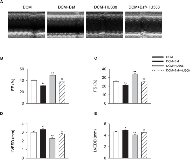 Bafilomycin A1 deteriorates the cardiac protective effect of HU308 in DCM mice. (A) Representative M-mode echocardiographic images on mice at 14 weeks after the final injection of STZ. (B–E) Quantitative analysis of cardiac function measurements including EF (%), FS (%), LVESD and LVEDD (n = 7). ∗P < 0.05 vs. DCM group; ∗∗P < 0.01 vs. DCM group; $$P < 0.01 vs. DCM+HU308 group. DCM, diabetic cardiomyopathy; Baf, bafilomycin A1.