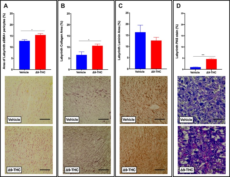 Exposure to 3 mg/kg Δ9-THC during gestation leads to increased pericyte and collagen area in the labyrinth zone at E19.5 compared to vehicle treatment. (A) Percentage of αSMA+ pericytes area and representative IHC for aSMA staining in labyrinth zone. (B) Percentage of collagen IV staining and representative IHC for collagen IV staining in the labyrinth. (C) Percentage of laminin staining and representative IHC for laminin staining in the labyrinth. (D) Percentage of PAS staining and representative PAS images in the labyrinth. 6-images/placenta were taken at 40x, graphs represent mean ± SEM, Significance; Student’s t-test (*P < 0.05, ***P < 0.001). Scale bars in (A–C) = 120uM; in (D) = 30 uM.
