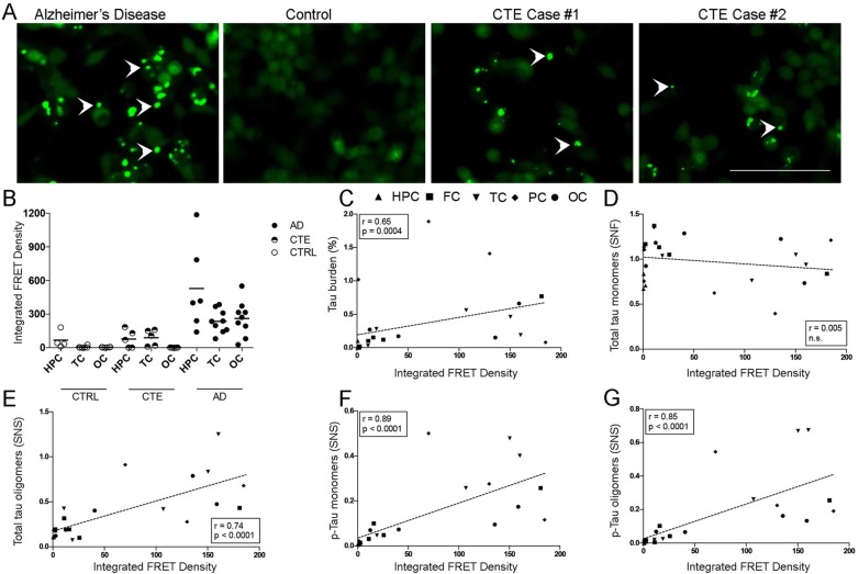 Representative confocal microscopy images showing tau aggregates in cells exposed to AD and CTE temporal cortex brain lysates (white arrow heads). No aggregates where detected in cells exposed to temporal cortex brain lysates from controls free of tau pathology (a). Quantification of IFD in ROIs from controls (n = 6), CTE (n = 5) and AD (n = 9) brain samples. IFD was significantly higher in AD than in CTE and control samples (p = 0.0009) (b). IFD values showed a significant correlation with total tau burden quantified by IHC (c) and with total levels tau oligomers (e), p-tau monomers (f) and p-tau monomers (g) but not with total tau monomers (d). Spearman r and p values are displayed on the graphs. Abbreviations: HPC: hipoccampus; FC: frontal cortex; TC: temporal cortex; PC: parietal cortex; OC: occipital cortex; IFD: integrated FRET density; IHC: immunohistochemistry. Scale bar = 100 μm