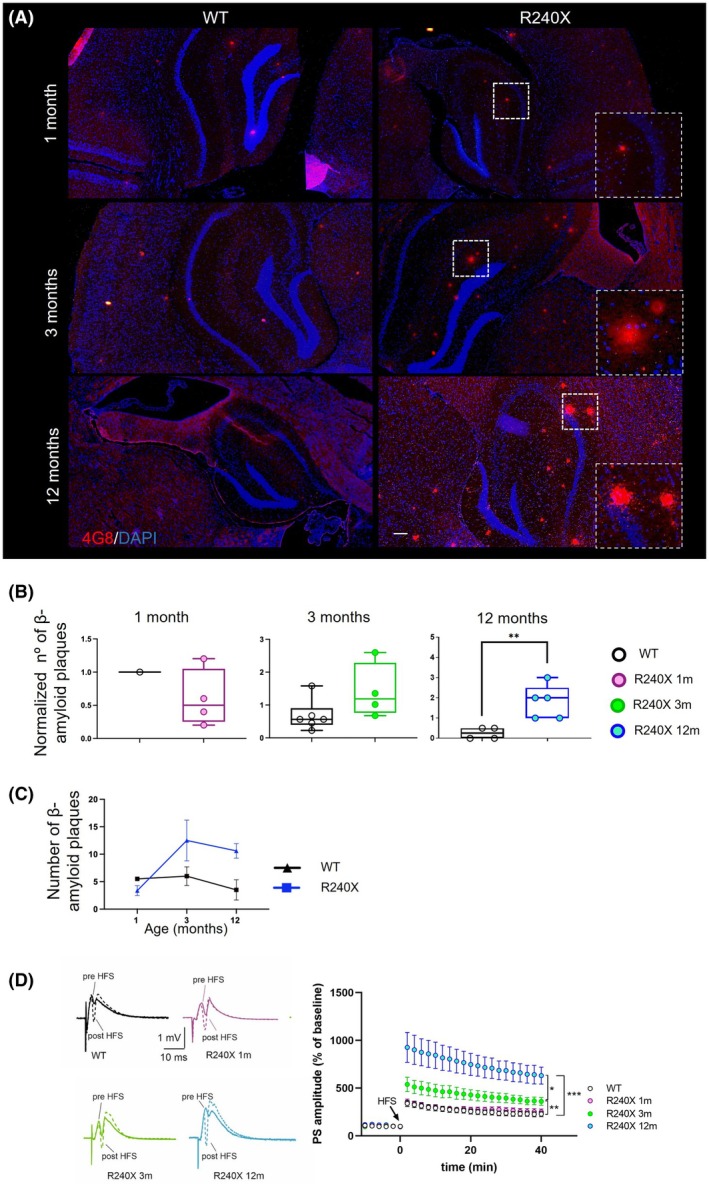 Quantification of amyloid beta (Aβ) plaques and time‐dependent LTP alteration in the DG of WT and Epm2a R240X mice. (A) Immunofluorescence using the 4G8 antibody revealed abundant presence of Aβ plaques in the hippocampal region of WT and Epm2a R240X mice. (B) Quantitative comparison of amyloid deposits in the hippocampus at 1, 3, and 12 months of age (1 month old: WT vs Epm2a R240X p = .4684; 3 months old: WT vs Epm2a R240X p = .0857; 12 months old: WT vs Epm2a R240X p = .0397). (C) Aβ depositions with age in the hippocampus of WT and Epm2a R240X mice (WT 1 month old vs 3 months old: p= > .9999; WT 1 month old vs 12 months old: p = .9982; WT 3 months old vs 12 months old: p = .9427; Epm2a R240X 1 month old vs 3 months old: p = .0731; Epm2a R240X 1 month old vs 12 months old: p = .1789; Epm2a R240X 3 months old vs 12 months old: p = .9848). Data are shown as the median of independent samples. Whiskers in box plots indicate the minimum and maximum values. For statistical analysis, a non‐parametric Mann–Whitney test and two‐way ANOVA with Tukey's multiple comparisons test were carried out. Scale Bar = 100 μm. n = 1–6 mice per genotype. (D) Representative PS traces recorded before (continuous line) and 40 min after (dotted line) the HFS protocol in DG slices of WT (black), 1‐ (pink), 3‐ (green), and 12‐month‐old (cyan) Epm2a R240X mice. The time–course plot of PS amplitudes recorded in the DG before and after HFS protocol shows a time‐dependent hyper‐plasticity in LD mice. Note that 1‐month‐old Epm2a R240X mice display a physiological LTP (WT: 230 ± 26.4%, n = 13; 1m‐R240X: 250 ± 31.4%, n = 5, p = .68, F (1,16)=.18 vs WT; 3m‐R240X: 437 ± 52.4%, n = 9, p = .006, F (1,19) = 9.56 vs WT; 12m‐R240X: 632 ± 89.3%, n = 9, p = .0001, F (1,20) = 22.74 vs WT; p = .0137, F (1,12) = 8.34 1m‐R240X vs 12m‐R240X; p = .032, F (1,15) = 5.35, 3m‐R240X vs 12 m‐R240X; two‐way ANOVA). Data are reported as means ± SEM, n refers to the number of slices. *p < .05, **p < .01, ***p < .001.