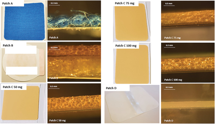 Images and cross‐sectional images of the six tested commercially available/market‐ready patches from four brands.