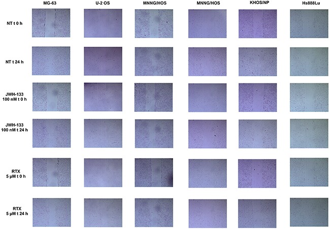Scratch Test on Human OS cell lines at T0 and after 24h of JWH-133 and RTX treatmentsThe representative images of scratch relative width (μm2) are displayed. Cells were plated in a 6-well plate. A single scratch was made at the confluence of 70%-80%. The scratch was monitored and photographed at 0 and 24 h post-treatment with JWH-133 [100nM] and RTX [5μM]. Images were taken on a AE2000 inverted microscope at 4x magnification.