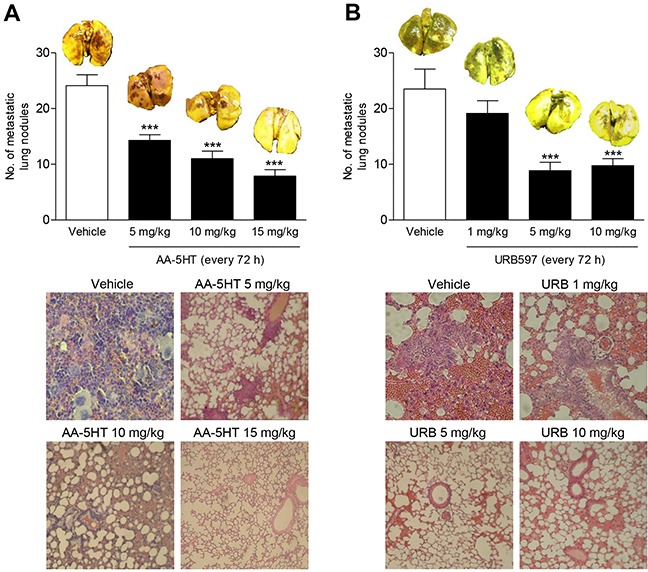 Impact of the FAAH inhibitors AA-5HT and URB597 on lung metastasis in nude miceA549 cells were injected intravenously in athymic nude mice. Mice were given intraperitoneal injections of AA-5HT A. and URB597 B. every 72 h for 28 days starting 24 h after injection of the cells. Complete lungs of animals sacrificed one day thereafter were evaluated for metastatic nodules after fixation in Bouin's fluid. Images above the histogram indicate Bouin's fluid-stained lungs; images below the histogram indicate hematoxylin/eosin stainings of paraffin sections from lungs. Values are means ± SEM of n = 7 - 9 (A) or n = 7 - 8 (B) animals per group. ***P < 0.001 vs. vehicle; one-way ANOVA plus post hoc Dunnett test.