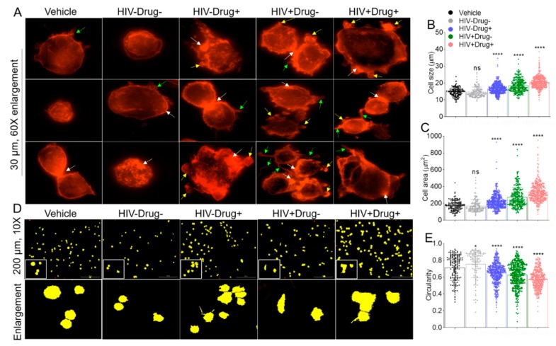 Altered monocyte morphometrics following treatment with SE from participants who used psychostimulants and/or were infected with HIV: (A) 60× fluorescence images of U937 monocytes plated atop collagen, treated with vehicle and different SEs as indicated in the figure, and stained with phalloidin to visualize actin membrane structures. Cells treated with SE-Drug or SE-HIV had distinct changes in morphology and exhibited significant membrane ruffles and filopodia-like extensions. White arrows indicate areas of increased F-actin localization. Green arrows indicate filopodia-like structures. Yellow arrows indicate membrane ruffles. Scale bar = 30 µm. The membrane tracing was used to assess monocyte circularity. The white box corresponds to the enlarged area. Scale bar is 200 µm. (B) Scatterplot of cell size. (C) Scatterplot of cell area. (D) Ten times representative membrane tracing (with fill) images of vehicle and different SE treatments obtained with the Lionheart FX Gen5 software. (E) Scatter plot of cell circularity. Calculations were performed by Lionheart FX Gen5 software. Ordinary one-way ANOVA (Dunnett’s correction) was used to determine the significance of SE treatments relative to vehicle. * p < 0.05, ** p < 0.01, *** p < 0.005, **** p < 0.001, and ns, nonsignificant.