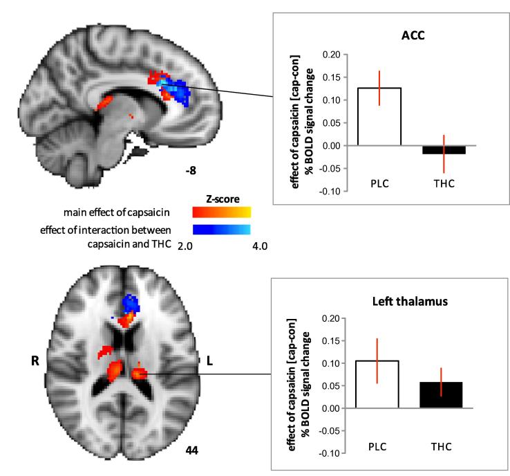 The main effect of capsaicin, indicated in red, was to increase blood-oxygen-level-dependent (BOLD) activation in the anterior cingulate cortex (ACC) (Montreal Neurological Institute [MNI] peak coordinates −6, 20, 30; z score = 3.8) and thalami (left thalamus: MNI peak coordinates −12, −26, 16; z score = 3.2, right thalamus: MNI peak coordinates 10, −22, 14; z score = 3.6). The effect of interaction between delta-9-tetrahydrocannabinol (THC) and capsaicin, indicated in blue, was significant in the ACC only (MNI peak coordinates −8, 22, 28; z score = 4.6). The graphs clarify the effects of THC and placebo (PLC) on capsaicin-induced BOLD responses. Capsaicin-induced BOLD response was calculated as the difference (cap − con) in percentage BOLD signal change between capsaicin (cap) and control (con) sessions. Compared to PLC, THC decreased the BOLD response in the ACC related to hyperalgesia (top graph). In contrast, activation within thalami related to hyperalgesia did not differ significantly. Coloured bars denote range of z scores. Clear and black bars represented PLC and THC, respectively. Error bars represent SEM.
