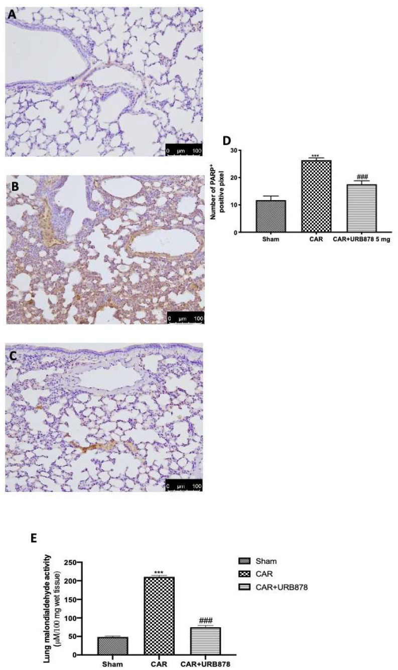 Effect of URB878 on PARP expression and MDA levels. Sham (A); CAR (B); CAR+URB878 5 mg/kg (C); graphical analysis (D) for PARP. Malondialdehyde activity levels (E); Scale bar for (A–C) was 100 μm; Values are means ± SEM of 6 mice for all groups. Photos shown are representative of the results obtained. See manuscript for further details. *** p < 0.001 vs. sham; ### p < 0.001 vs. CAR.
