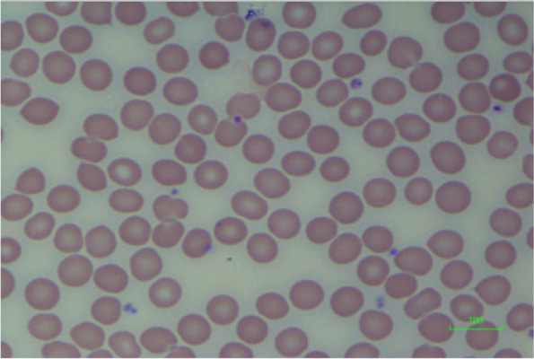 Blood film of control sample. Normal RBC morphology (control sample). Scale = 100 μm