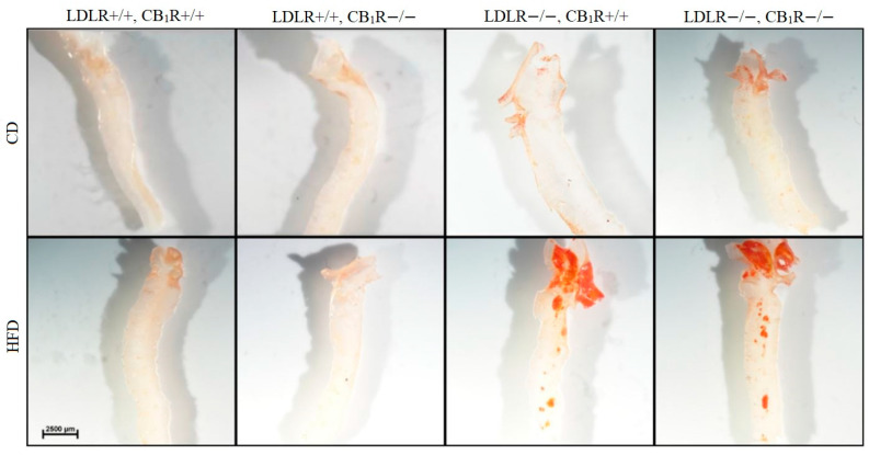 Oil Red stained microscopic image of dissected aortic arch in mice with genotypes LDLR+/+CB1R+/+ (wild-type), LDLR+/+CB1R−/−, LDLR−/−CB1R+/+ and LDLR−/− CB1R−/− kept on control diet or on high-fat diet for 5 months. Scale bar indicates 2500 µm. Abbreviations: LDLR: low-density lipoprotein receptor, CB1R: cannabinoid type 1 receptor, CD: control diet, HFD: high-fat diet.