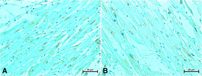 Immunodetection of CB2 receptor in the heart of women (a) under 50 and (b) over 50 years old