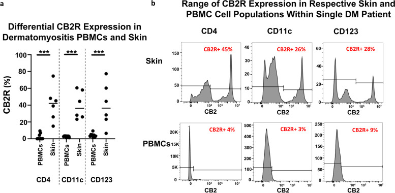 CB2R distribution among DM skin and DM PBMCs via flow cytometry. DM and HC peripheral blood PBMCs and skin cells isolated and stained via flow cytometry. a Percentage of CB2R expression in CD4+ T cells, CD11c+ mDCs, and CD123+ pDCs compared between DM peripheral blood and skin. b CB2R expression in skin and peripheral blood samples of a single patient shown with respect to CD4+ T cells, CD11c+ mDCs, and CD123+ pDCs. Graph shows the median. ***p<0.001. DM, dermatomyositis; HC, healthy control; mDC, myeloid dendritic cells; PBMC, peripheral blood mononuclear cell; pDC, plasmacytoid dendritic cell