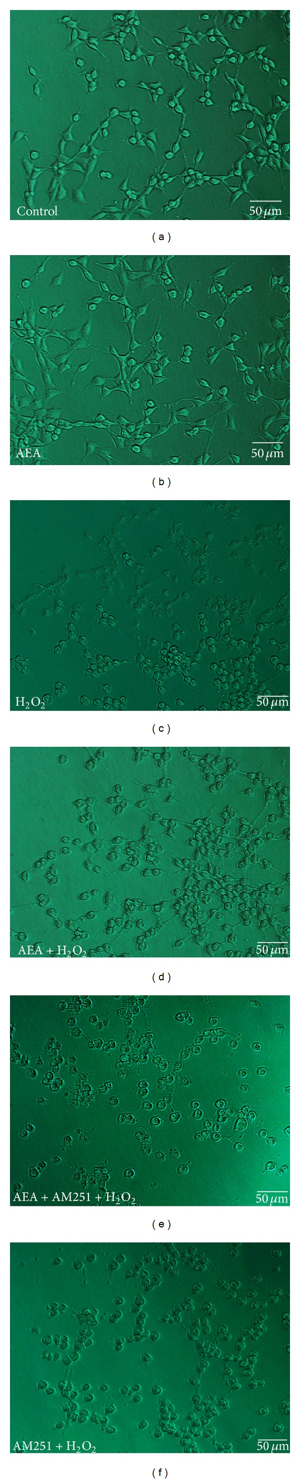 AEA ameliorated the morphology of HT22 cells exposed to H2O2 via CB1. (a) Control cells cultured in drug-free medium. (b) Cells exposed to 10 μM AEA for 3 h. (c) Cells exposed to 200 μM H2O2 for 3 h. (d) Cells exposed to 10 μM AEA plus 200 μM H2O2 for 3 h. (e) Cells exposed to 10 μM AEA plus 10 μM AM251 at the presence of 200 μM H2O2 for 3 h. (f) Cells exposed to CB1 antagonist AM251 of 10 μM plus 200 μM H2O2 for 3 h. H2O2 markedly damaged the cell morphology and hindered the growth of neurites. AEA attenuated the H2O2-induced injury of HT22 cells whereas CB1 antagonist AM251 reversed the AEA-induced protective effect on cell morphology. Bar = 50 μm.