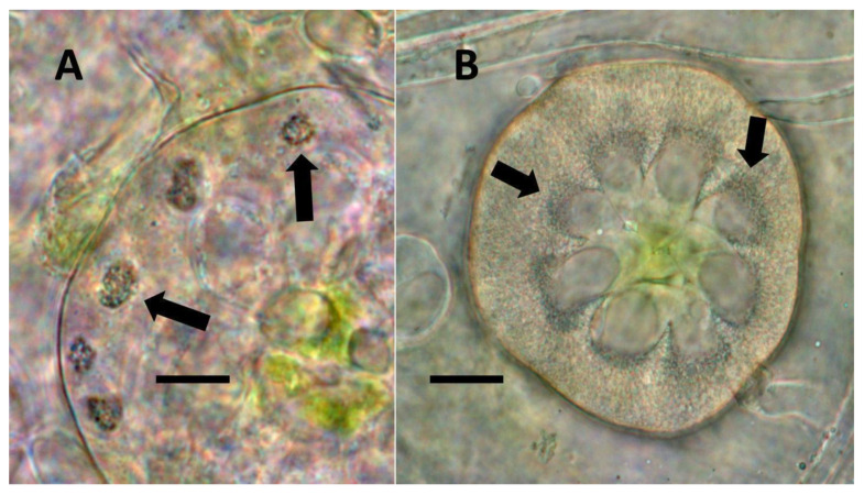Glandular trichomes of Cannabis sativa. (A) Developing glandular trichome of hemp stained with nitro blue tetrazolium to show superoxide (blue-purple color) around clusters of bacteria (arrows) in hair (Bar = 10 µm). (B) More mature glandular trichome of hemp stained with nitro blue tetrazolium to show superoxide (blue-purple color) (arrows) at the interface of central plant cells and peripheral bacteria in hair (Bar = 10 µm).