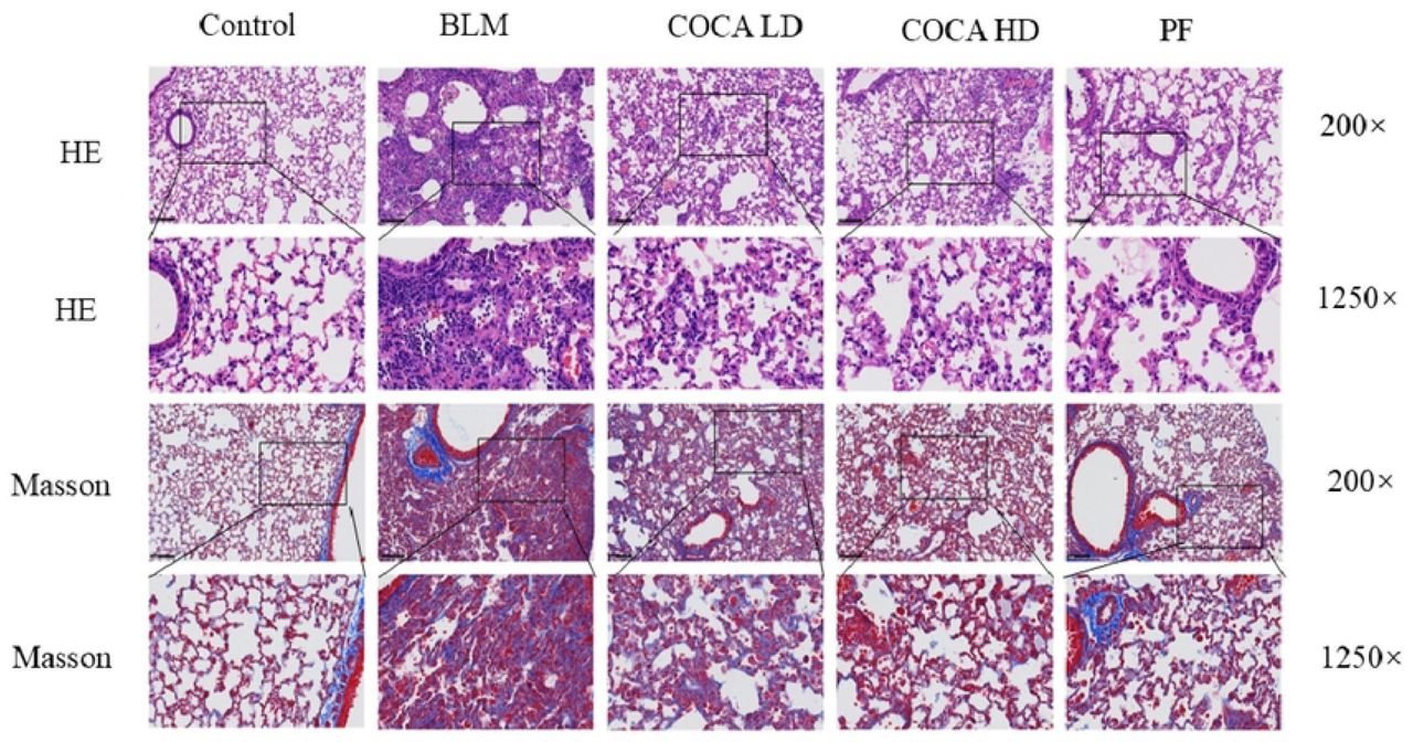 HE staining and Masson staining of lung tissues of mice in each group (200×&1250×) the Control group had normal alveolar structure with no inflammation on day 7. The BLM group showed severe damage, including disorganized alveoli, thickened septa, and inflammation. The treatment groups had milder changes, with less inflammation and more uniform tissue structure. Masson’s staining showed high collagen levels, structural damage, and fibroblast growth in the BLM group—signs of advanced fibrosis. COCA and pirfenidone reduced collagen buildup and structural damage. The COCA HD group showed the best improvement, with clearer lung structure and less collagen.