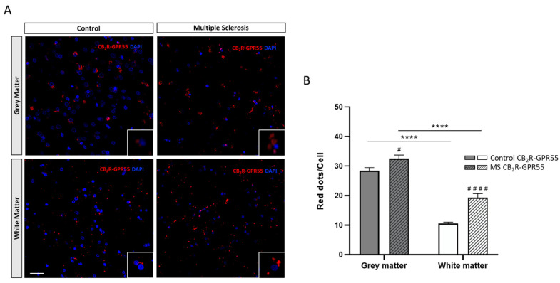 CB2R-GPR55 heteromers detected using the In Situ Proximity Ligation Assay (PLA) in the grey (GM) and white matter (WM) of the prefrontal cortex of samples from the controls and multiple sclerosis (MS) patients. Representative confocal images (40×) showing the PLA label for CB2R-GPR55 heteromers as red dots in cells with DAPI-stained nuclei. Scale bar 50 µm (A). Quantification of CB2R-GPR55 heteromers as the number of red dots per cell in the GM and WM in the prefrontal cortex samples of the controls and MS patients. Data are the mean ± SEM (40 fields per section) (B). Significant differences were analyzed via two-way ANOVA followed by post hoc Bonferroni’s test. **** p < 0.0001 compared with GM; # p < 0.05, #### p < 0.0001 compared with the control.