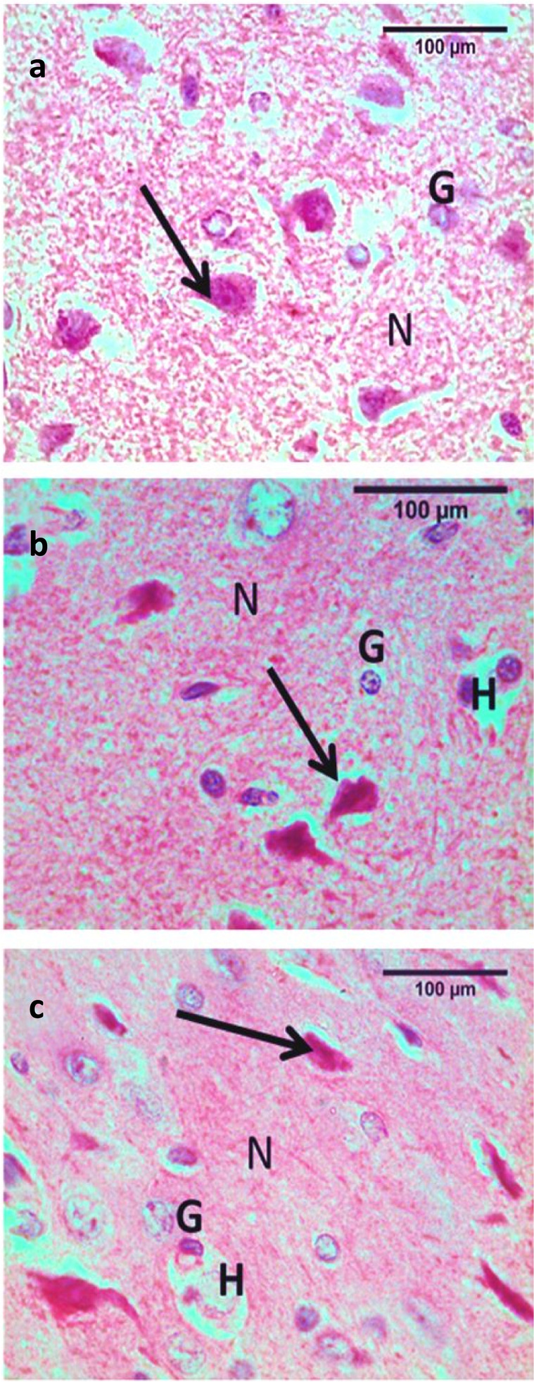 Photomicrographs of cortical brain sections of WIN55, 212–2 treated mice versus controls. Image a: control and vehicle groups showing rounded non pyramidal granule cells (G) with open face nuclei and large sized pyramidal cells (arrow) with triangular shaped cell bodies, basophilic cytoplasm, rounded nuclei, and long apical dendrites. The ground substance between the nerve cells was normally occupied with homogenous eosinophilic neuropil (N). Image b: the low dose groups showing some pyramidal cells are deformed with deeply stained nuclei and surrounded by haloes (arrow), granule cells (G) with dark smaller nuclei surrounded by halo (H) nuclei and neuropil (N) in between cells. Image c: the high dose groups show more deformed and shrinked pyramidal cells (arrow), granule cells (G) with dark smaller nuclei surrounded by halo (H) nuclei and neuropil (N) in between cells. Stain H&E (scale bar = 100um)