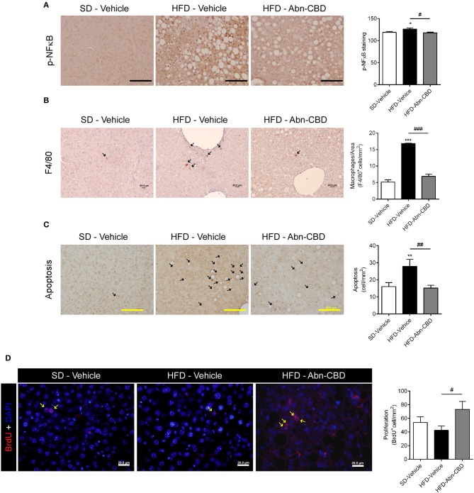 Effect of Abn-CBD on hepatocyte viability and liver inflammation. (A) Representative photomicrographs and quantification of livers stained for the inflammatory marker p-NFκB (A), the macrophage marker F4/80 (B) and apoptotic cells (C); arrows indicate stained cells; scale bar is 100 μm (A), 20 μm (B), and 200 μm (C). (D) Representative photomicrographs and quantification of BrdU immunofluorescence (in red) in the liver, counterstained with DAPI (in blue). Arrows indicate proliferating cells. n = 7–8 SD-Vehicle, n = 5–8 HFD-Vehicle and n = 6–8 HFD-Abn-CBD. *p ≤ 0.05, **p ≤ 0.01, and ***p ≤ 0.001 compared to SD-Vehicle; #p ≤ 0.05, ##p ≤ 0.01, and ###p ≤ 0.001 compared to HFD-Vehicle.