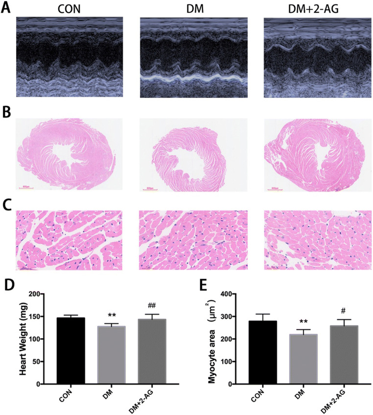 2-AG improves cardiac function and ventricular remodeling in diabetic mice A. Representative images of M-type echocardiograms. B. Overall view of H&E staining. Scale bar, 600 μm. C. Representative diagram of H&E staining cross section of the heart. Scale bar, 30 μm. D. Heart weight. E. Statistical graph of myocardial cross-sectional area. **P < 0.01, ***P < 0.001, compared with the CON group; #P < 0.05, ##P < 0.01, compared with the DM group. n = 7