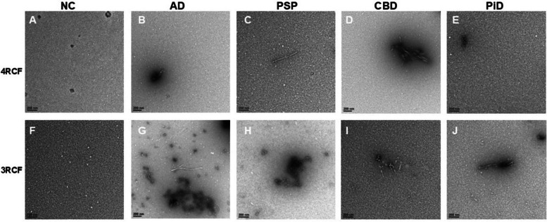 Transmission electron microscopy of SAA end products of skin misfolded tau from AD, other tauopathies and normal controls. Panels (A) through (E) show the representative images of tau 4RCF-based RT-QuIC end-products with normal controls (NC, A), AD (B), PSP (C), CBD (D) and PiD (E). Panels (F) through (J) exhibit the representative images of tau 3RCF-based RT-QuIC end-products with NC (F), AD (G), PSP (H), CBD (I) and PiD (J). Scale bars: 200 nm