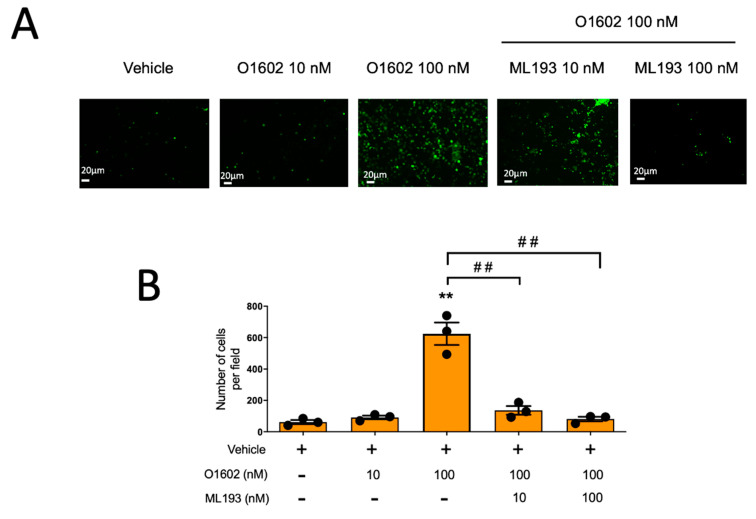GPR55-specific agonist O1602 causes GPR55-dependent migration in BMMCs. Panel (A): representative image of a filter obtained in a migration assay of BMMCs towards distinct concentrations of O1602 alone or in the presence of ML193. Panel (B): quantification of cell migration of BMMCs towards O1602; ** p < 0.01 vs. vehicle; ## p < 0.01 vs. O1602.